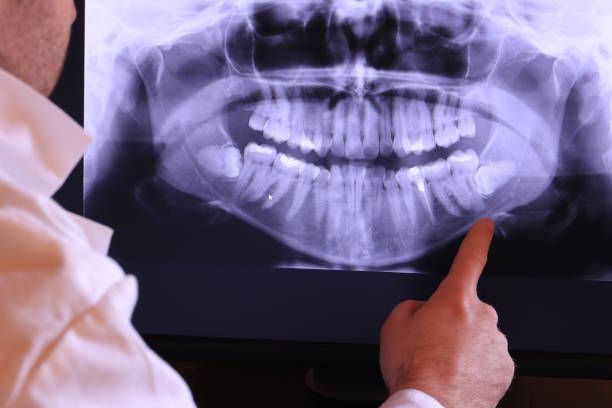 Best Emergency Gum Pain Relief  in Bear, DE